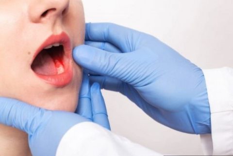 5 Cara Mencegah Kanker Mulut yang Bisa Kamu Lakukan